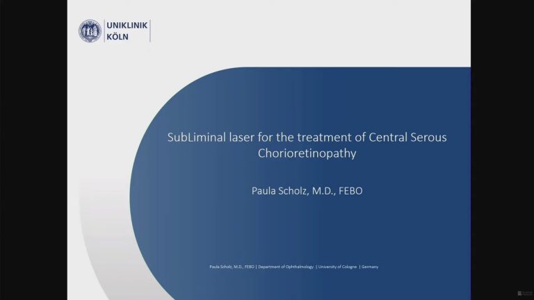 LONDON-2018-Suliminal-laser-for-the-treatment-of-central-serous-chorioretinopathy-Miniature