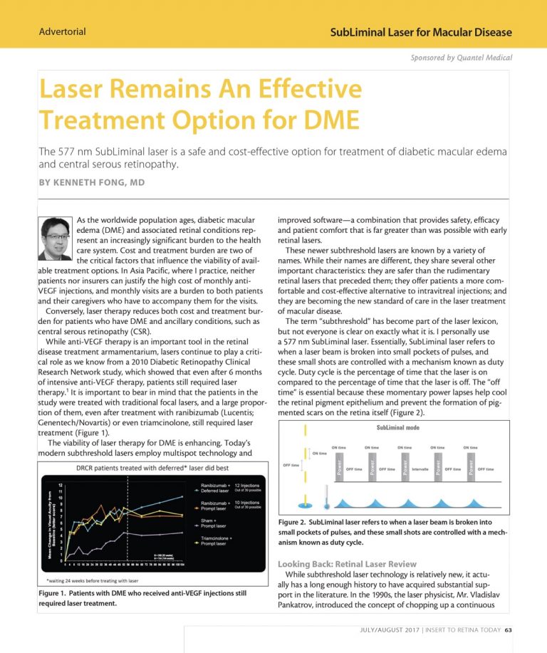 Laser Remains An Effective Treatment Option for DME