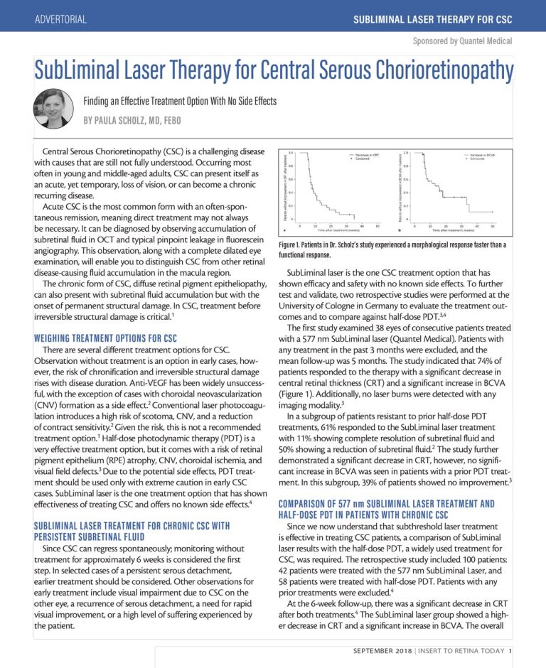SubLiminal Laser Therapy for Central Serous Chorioretinopathy