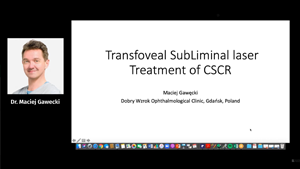 Transfoveal subliminal laser treatment of CSCR