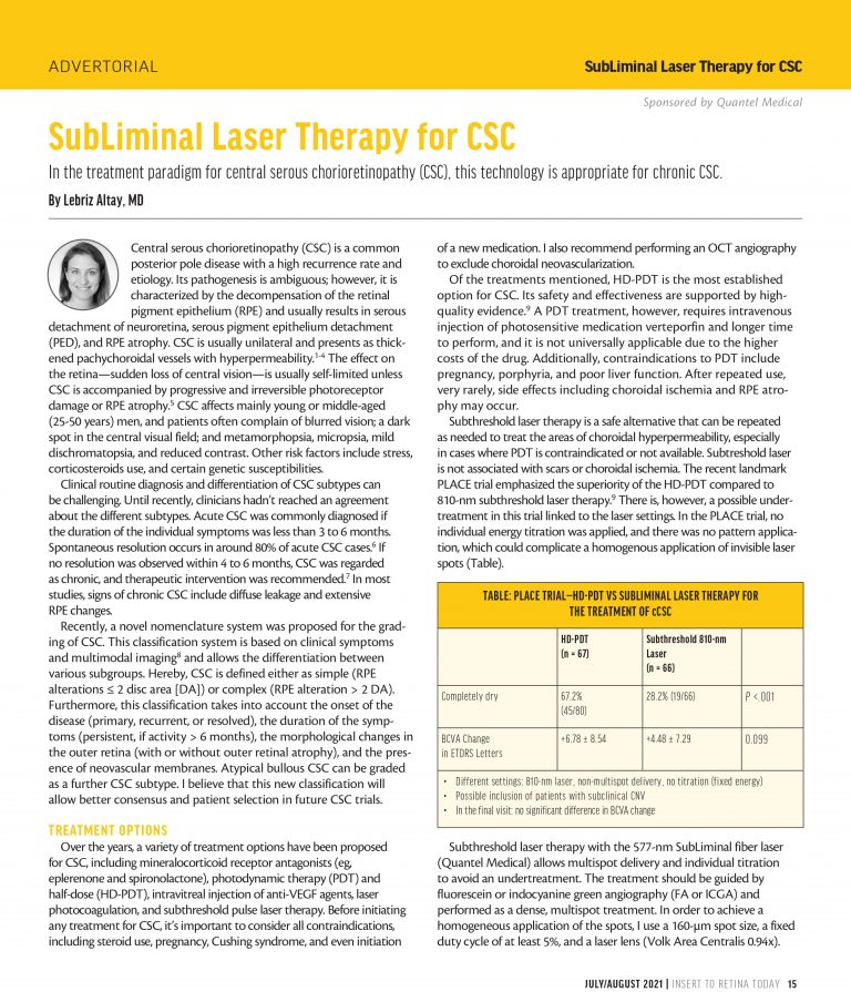 Subliminal Laser Therapy - A Macular Treatment 20 SubLiminal Laser Therapy for CSC