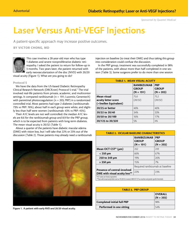Laser Versus Anti-VEGF Injections